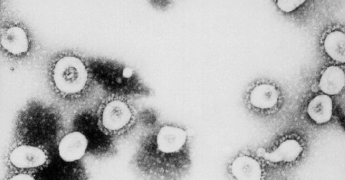3 students from UW screened for coronavirus - KIRO Seattle thumbnail